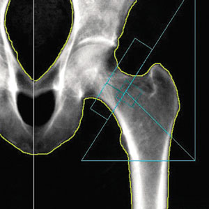 X-ray image